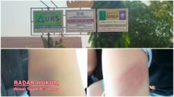 Diduga Oknum Guru Pukul 2 Siswa di SDN 1 Pandansari, Korban Alami Memar dan Bengkak