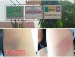 Diduga Oknum Guru Pukul 2 Siswa di SDN 1 Pandansari, Korban Alami Memar dan Bengkak